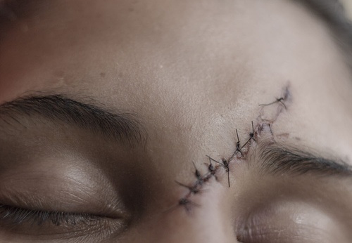 Gallery of Photojournalism by Fabiola Ferrero – Venezuela