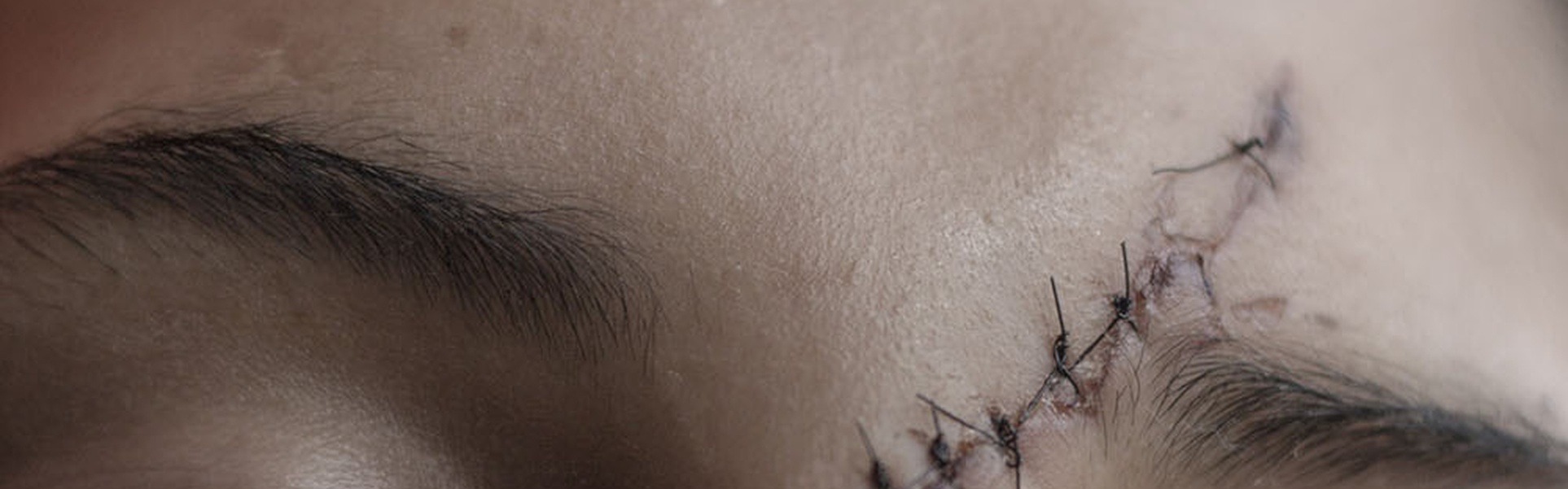 Gallery of Photojournalism by Fabiola Ferrero – Venezuela