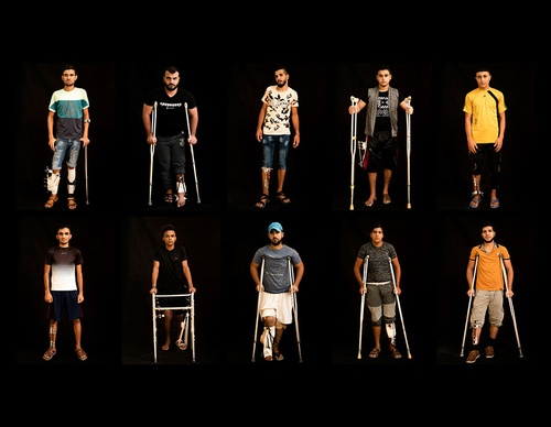 Portraits of War Trauma in Gaza – Felipe Dana, Brazilian Photographer
