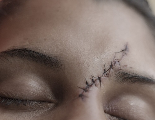 Gallery of Photojournalism by Fabiola Ferrero – Venezuela
