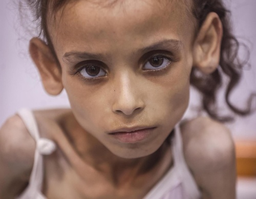 ali jadallah gaza