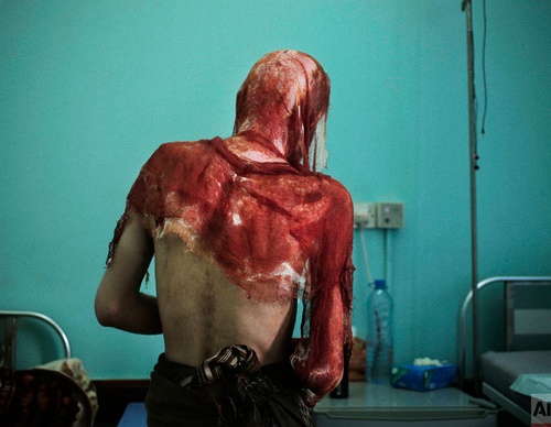 ap images middle east