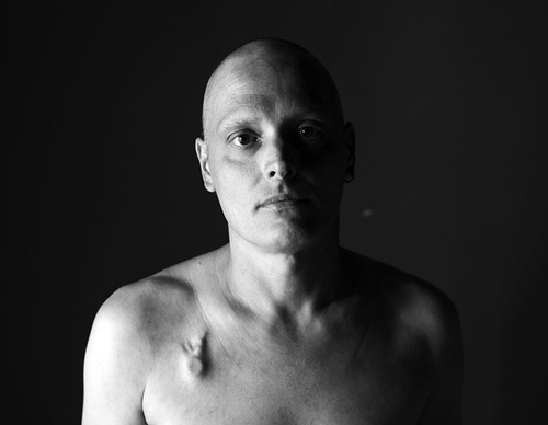 world press photo
