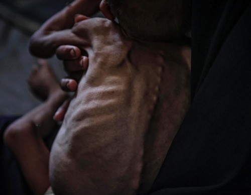 ali jadallah gaza