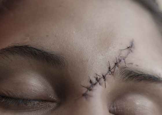 Galería de Fotoperiodismo de Fabiola Ferrero – Venezuela